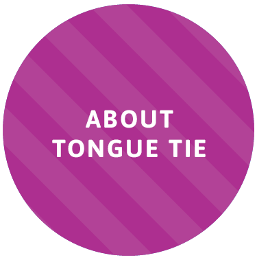 About Tongue Tie